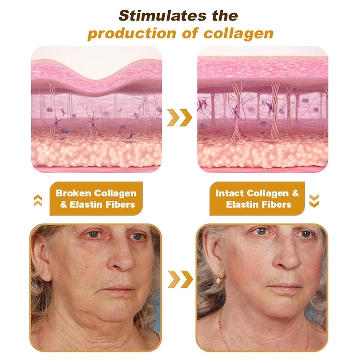 Botox Bee Venom Cream 50g (Pack of 2)